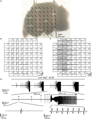 The Subiculum: A Potential Site of Ictogenesis in a Neonatal Seizure Model